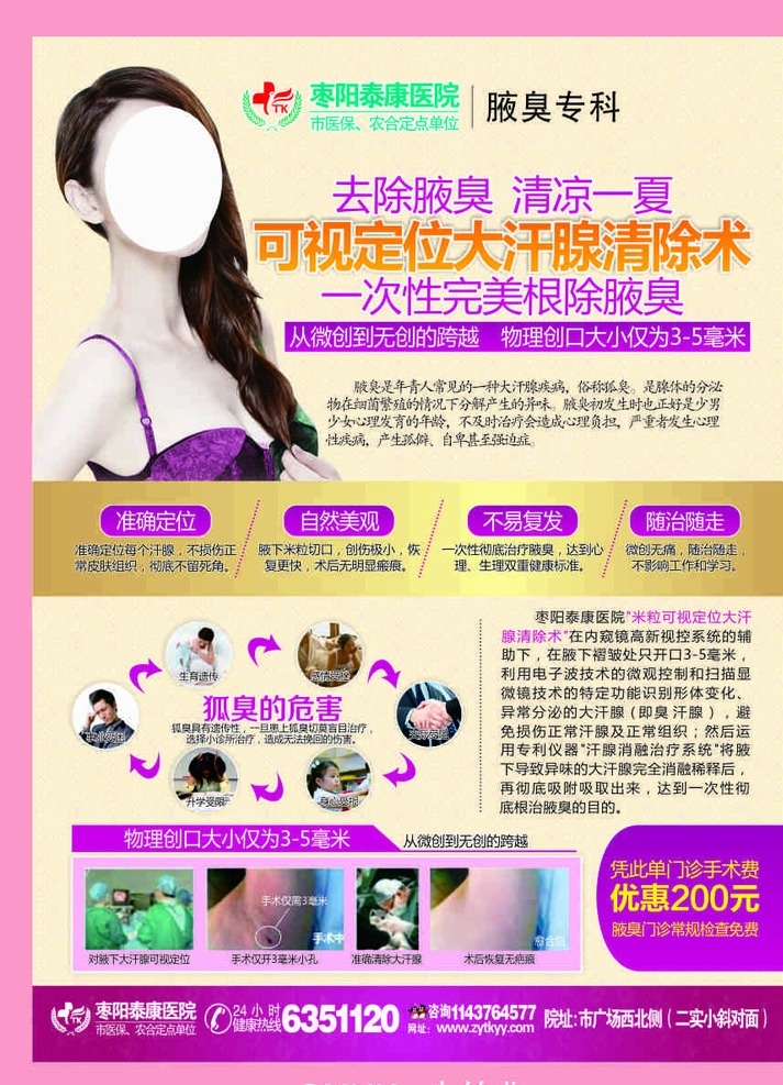 宣传单页 腋臭 腋臭单页 腋臭广告 腋臭微创广告 报纸广告 微创腋臭 美女 美女腋臭 报纸设计 腋臭设计 技术 dm宣传单