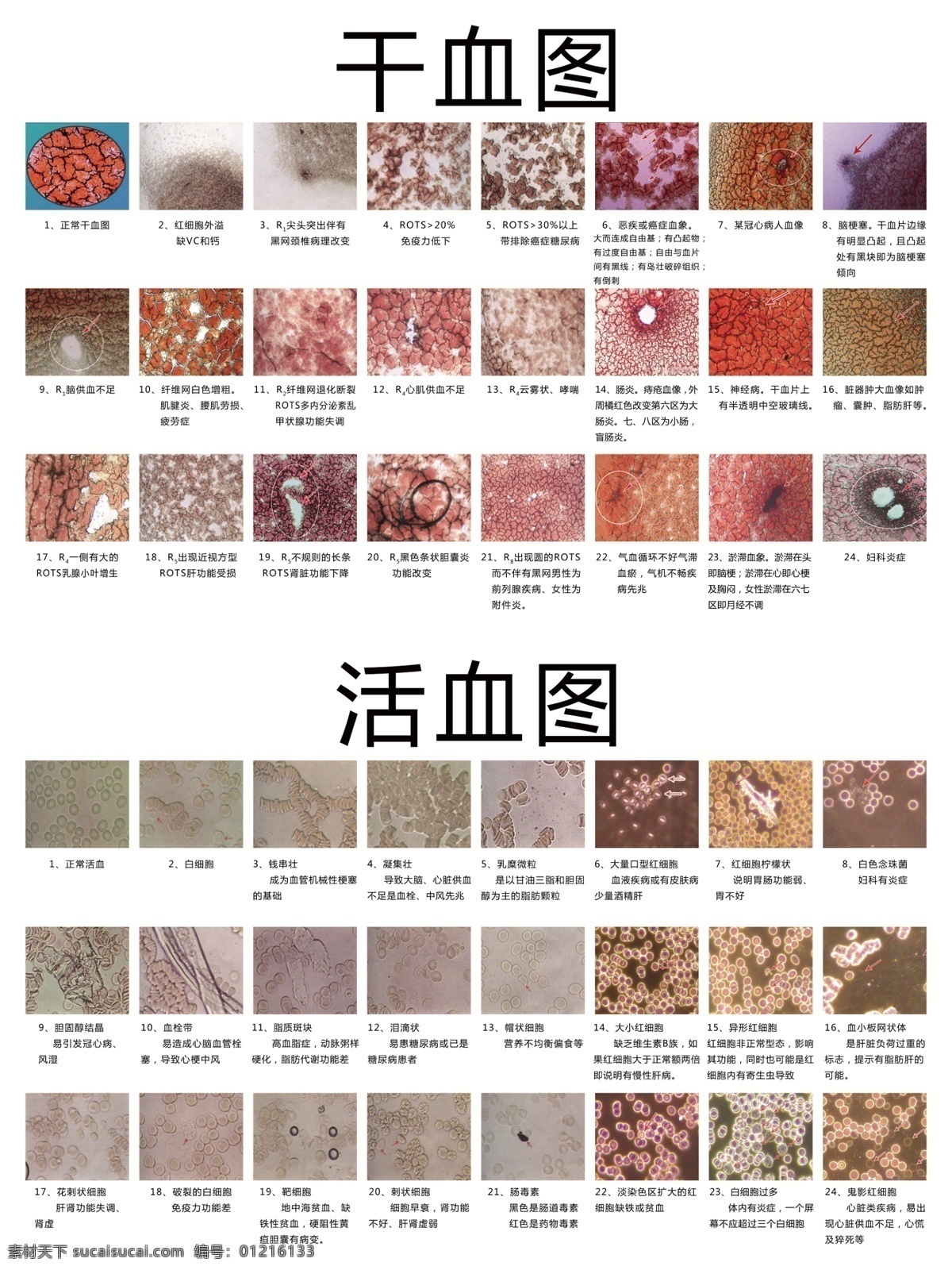 干 血 图 活血 干血图 活血图 细胞图 干血 展板 x240 240 cm