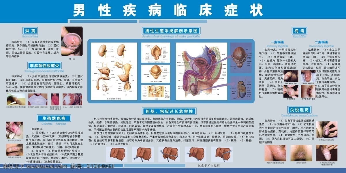 男性 疾病 临床症状 男科 泌尿外科 科室挂图 男科挂图 生殖系统 包皮 淋病 梅毒 尖锐湿疠 包茎 疱疹 尿道炎 解剖图 展板模板 广告设计模板 源文件