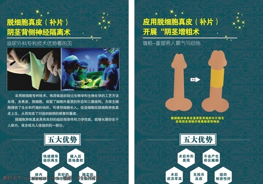 医院 脱 细胞 真皮 男性健康 脱细胞专利 泌尿外科 生物化学 异体真皮 阴茎增粗术 隔离背部神经 组织缺损 补片填充 世界卫生组织 中国性学会 宣传海报
