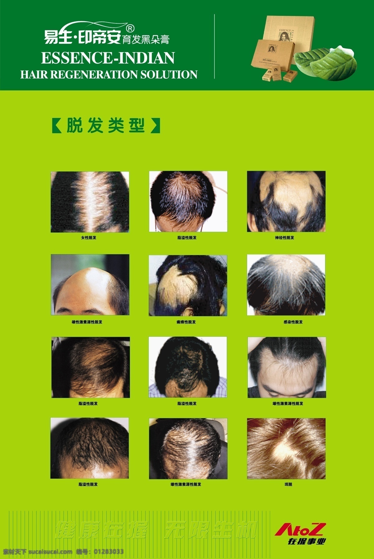 脱发 制疗脱发 防脱 易生 印帝安 海报 展板 矢量图库