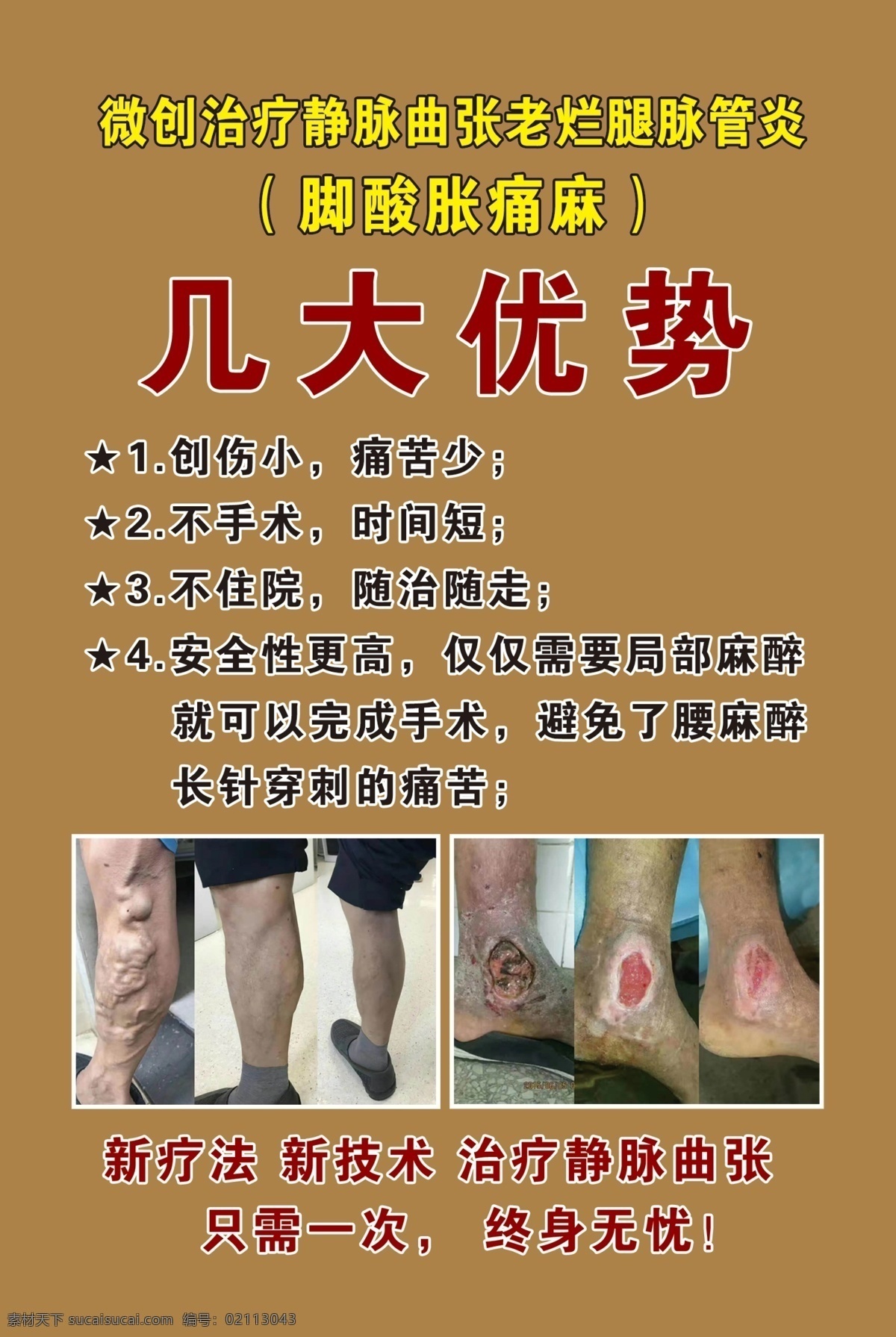 中医展板 中医海报 痰湿的表现 中医药材 中药 静脉曲张 几大优势
