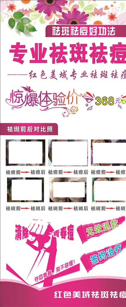 专业 祛斑 祛痘 海报 专业祛斑祛痘 祛斑写真 祛斑海报 祛痘海报 祛斑祛痘海报 美容海报 美容模板 祛斑祛痘展板