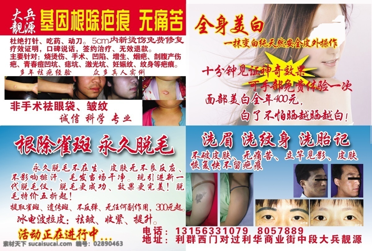 祛痣免费下载 dm宣传单 彩页 广告设计模板 美白 美容 脱毛 源文件 祛痣 除疤 妊娠纹 洗胎记 去纹身 海报 宣传海报 宣传单 dm
