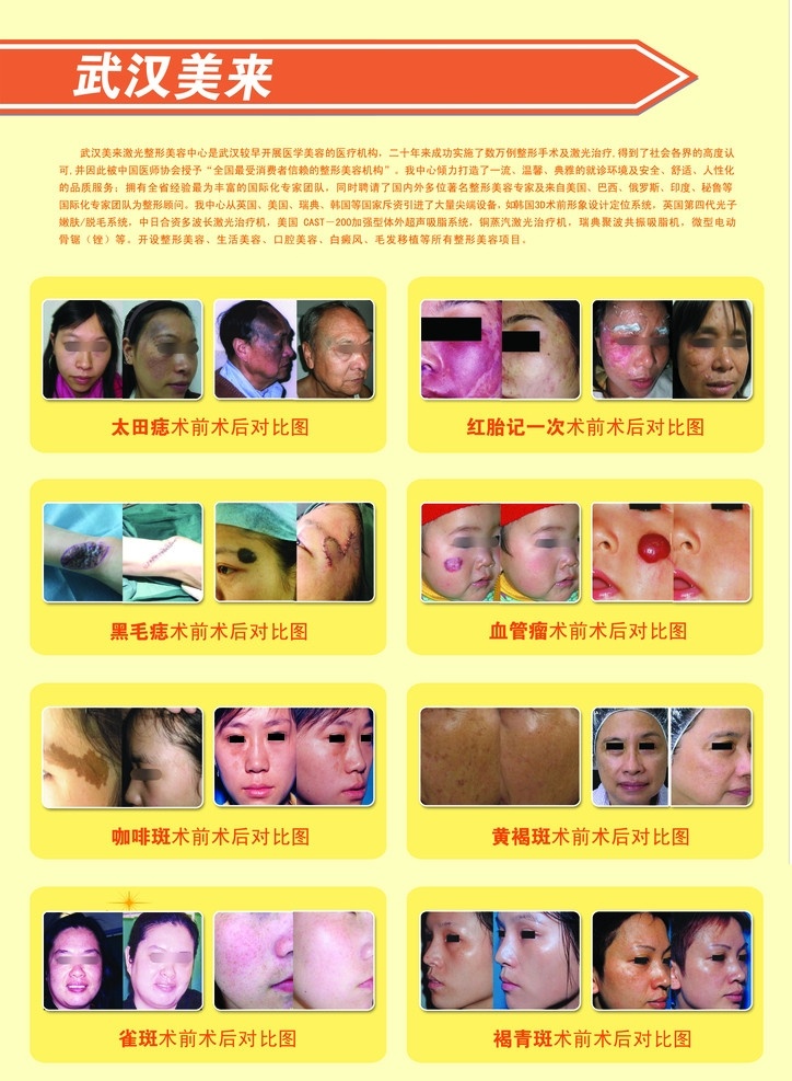 武汉来美 宣传单设计 整形美容 手术对比图 箭头 胎记 dm宣传单 广告设计模板 源文件