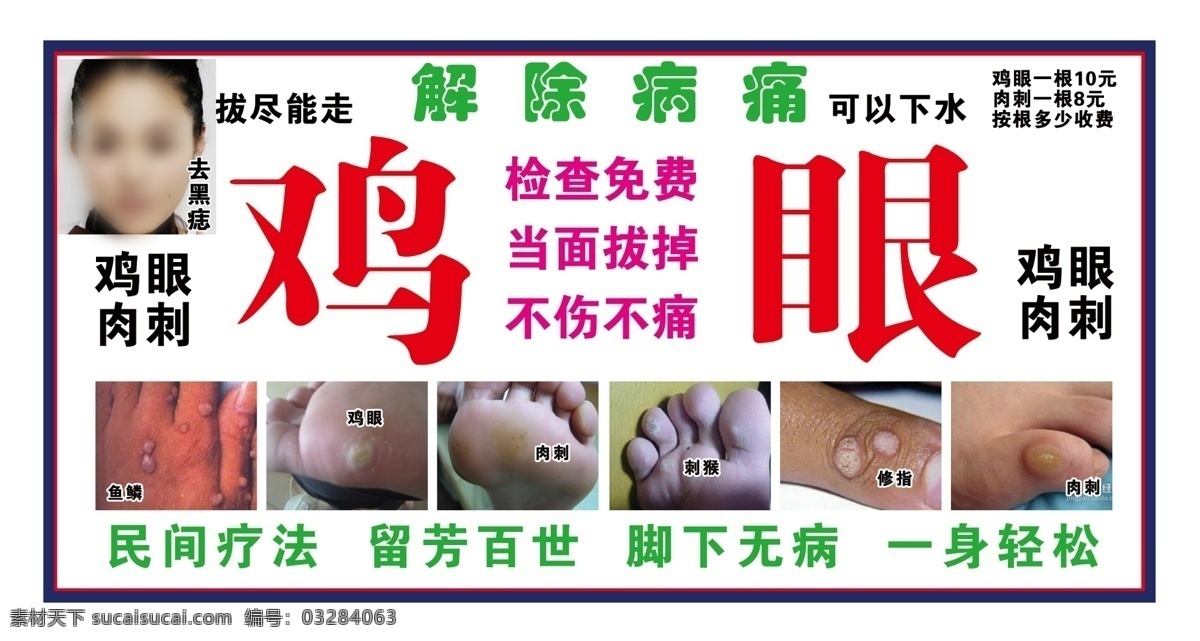 鱼鳞 鸡眼 肉刺 刺猴 皮肤病 猴子 去黑痣 痣 斑 修脚 修足 足
