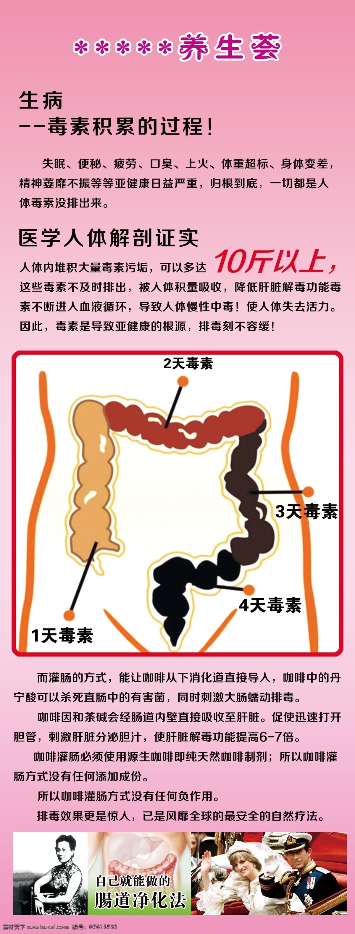 肠道展架 毒素 宋美龄 戴安娜王妃 肠子 肠毒 展架 广告 写真 灌肠咖啡