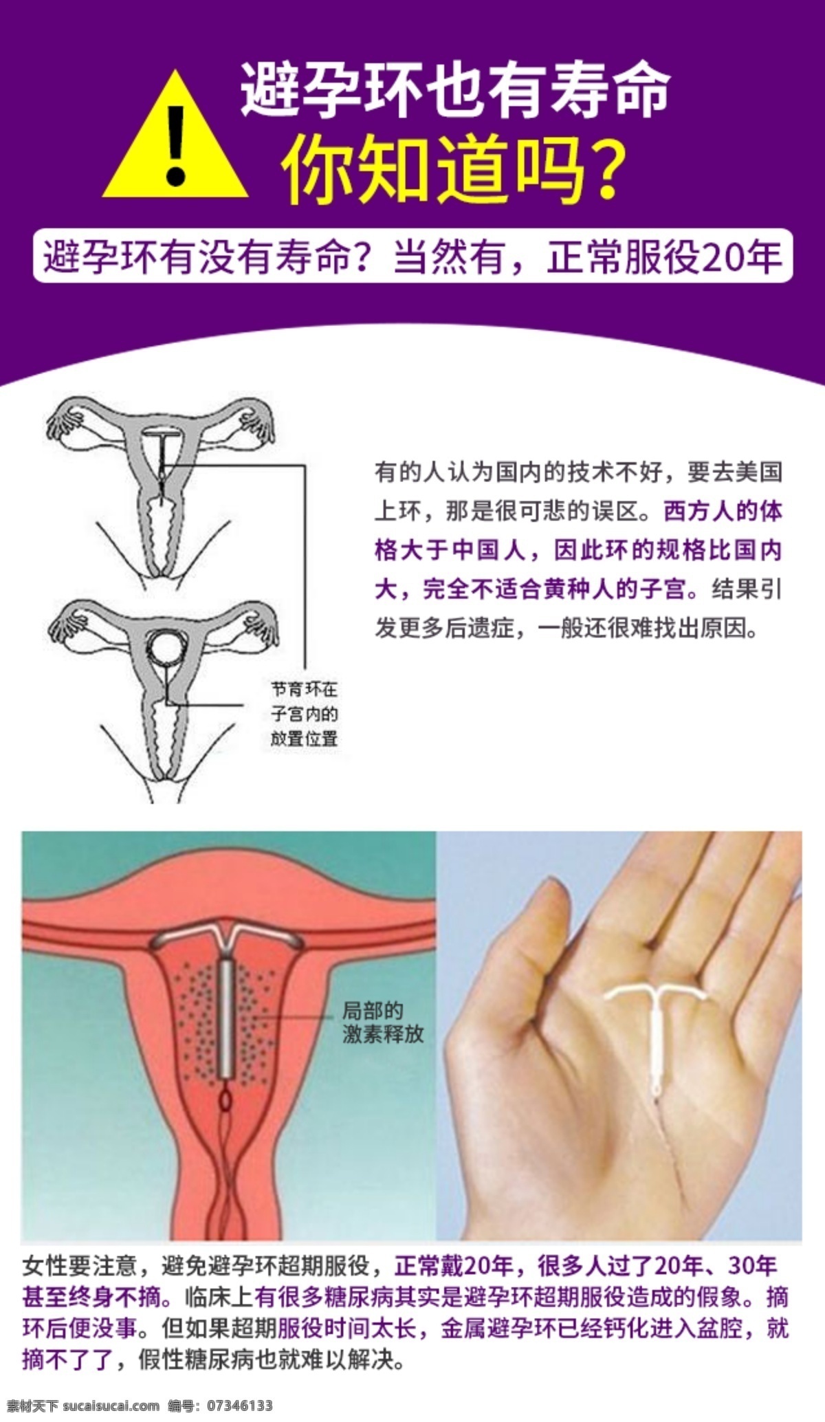 避孕环 寿命 知道 女性避孕 女性健康 避孕环寿命 海报 分层