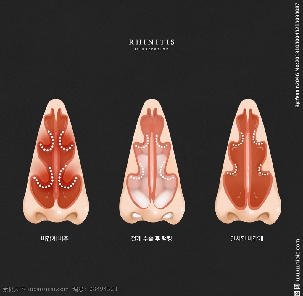 咽喉 医疗 图案 人物 人体结构 肺部 医学 医院 医药海报 背景模板 治疗 创意 图案设计 分层