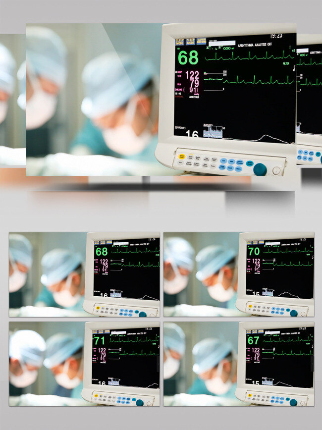 医院 医生 手术 进行 中心 电 监护 实拍 视频 2018年 高清实拍 实拍视频 实拍素材 手术室 心电监护 医疗教育
