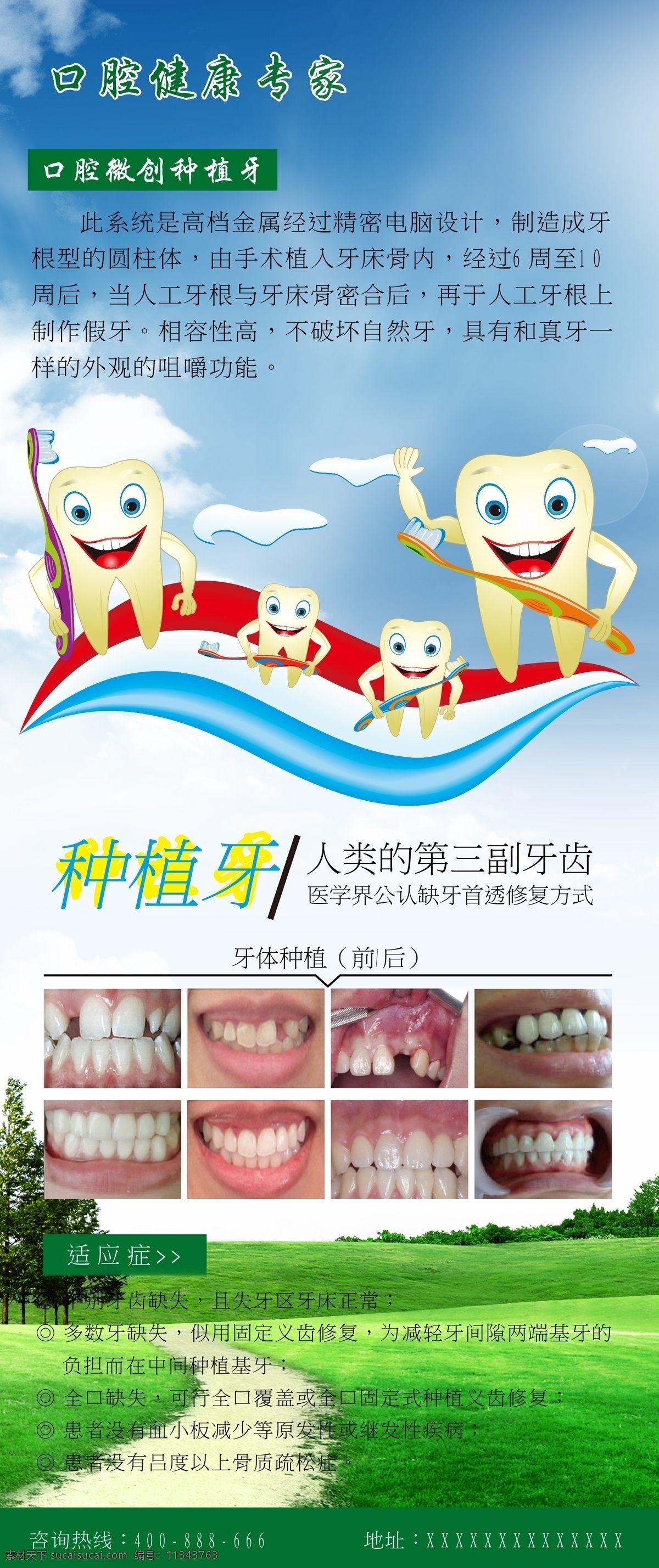 x展架 牙 牙齿 牙齿海报 易拉宝 种植牙 海报 矢量 模板下载 牙齿失量图 口腔专家 展板 x展板设计