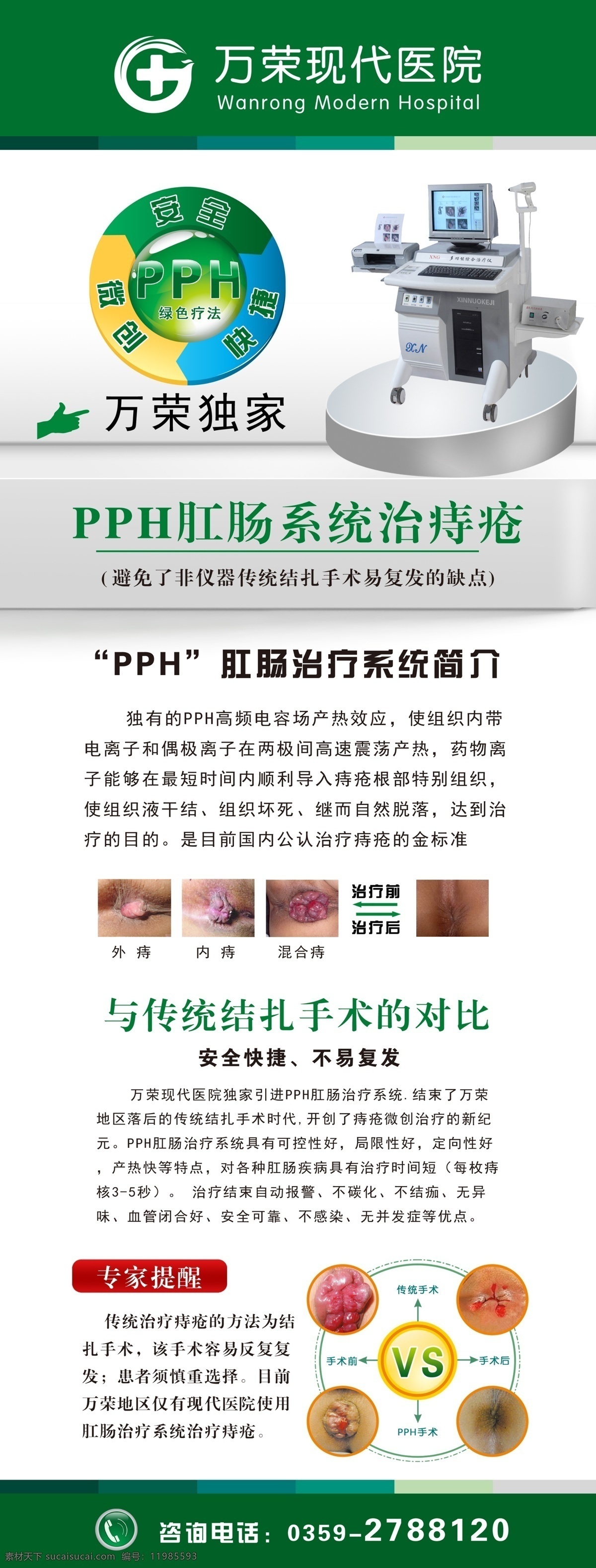 肛肠科广告 肛肠科 医院x展架 肛肠科x展架 x展架 医院展架 pph 肛肠 治疗仪 痔疮广告 痔疮 对比图 肛肠广告 肛肠镜 万荣现代医院 医院广告 绿色疗法 专家提醒 医院展板 医院展板模板 展板模板 广告设计模板 源文件