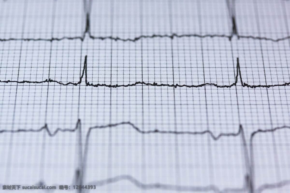 特写 心脏 曲线 跳动 生命 音波 心电图报告 报告 现代科技 医疗护理