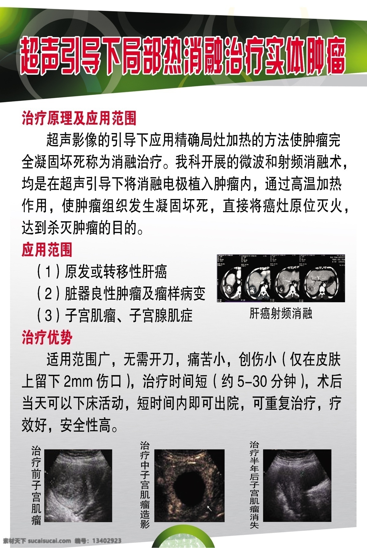 医院展板 超声波检查 肺 肝 妇科 超声波图像 展板模板 广告设计模板 源文件