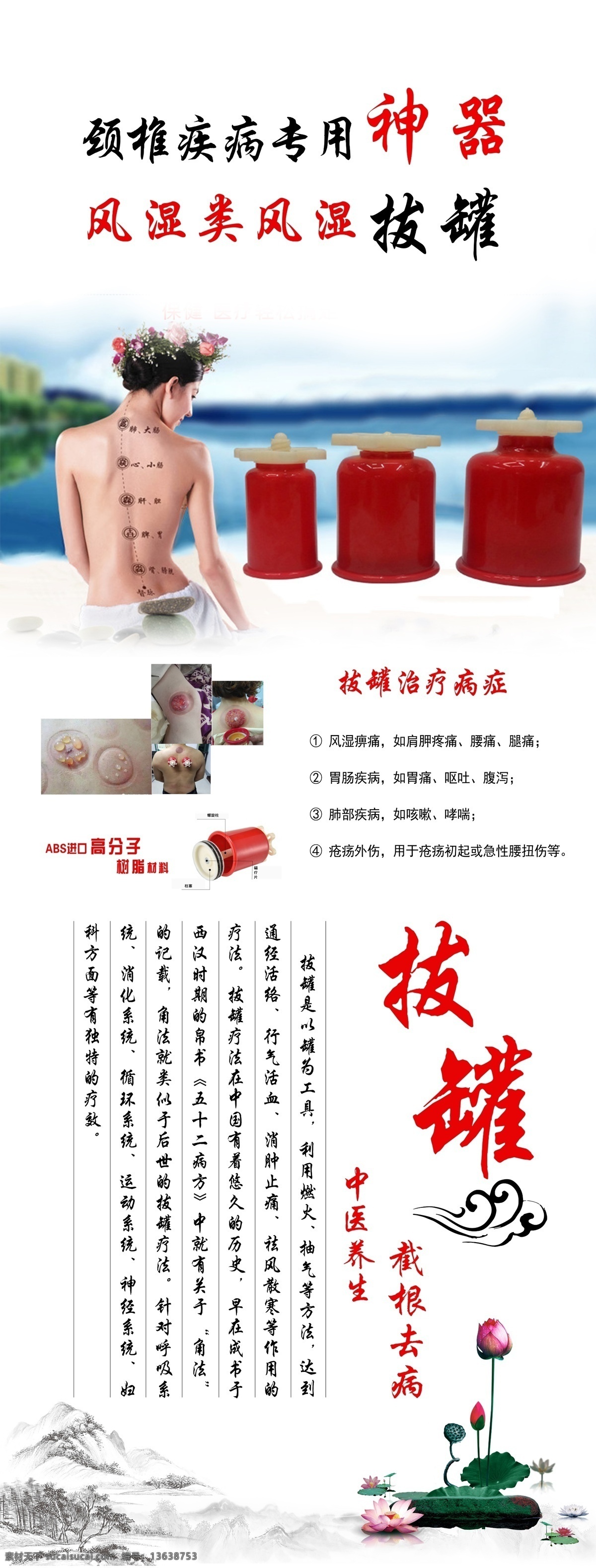 拔罐易拉宝 拔罐展架 拔罐彩页 易拉宝展架 拔罐海报 拔罐元素 拔罐素材 拔罐
