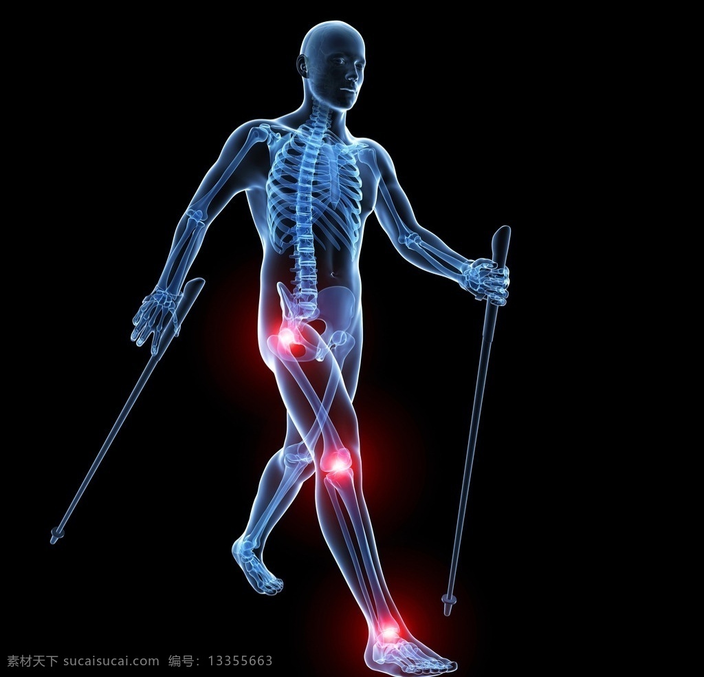 人体透视图 x光图 人体图 膝关节 人体蓝光图 医疗素材 生活百科 医疗保健